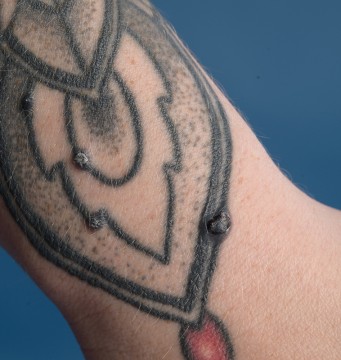 Tatoeage met bultjes