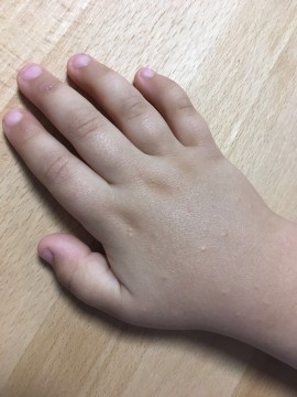 Cas Algehele malaise