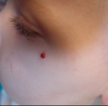 Poll baby met plekje