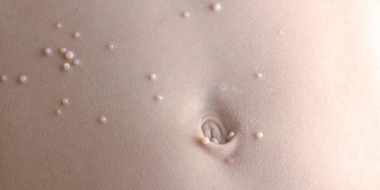 waterwratjes op buik