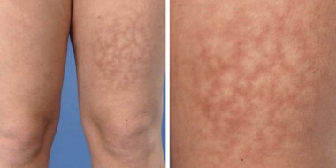 Close-up van kachelbenen