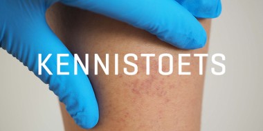 Rode vlekjes op een been