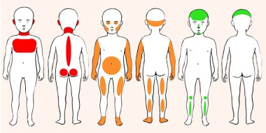 Locaties van accidentele blauwe plekken