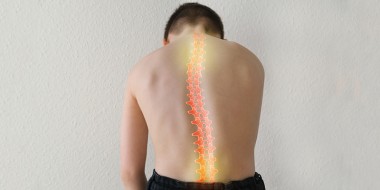 Rug van kind met scoliose