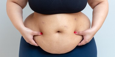 Medicatie bij obesitas