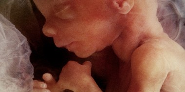 Aspirinegebruik bij zwangere vrouwen 