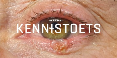 Illustratie kennistoets