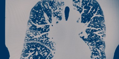 COPD versus hart- en vaatziekten