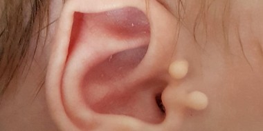 Close-up van bijoortjes bij een klein kind