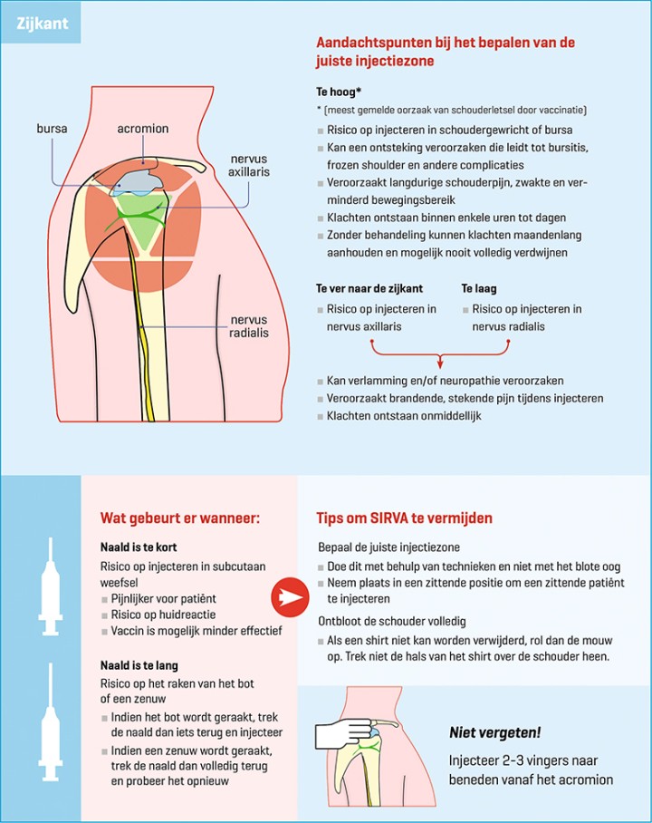 Shoulder Injury Related to Vaccine Administration (SIRVA)