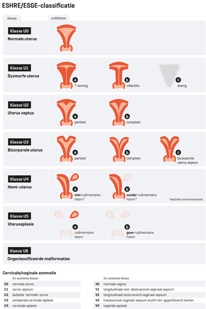 ESHRE/ESGE-classificatie