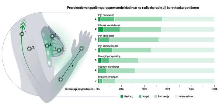 Klachten na radiotherapie