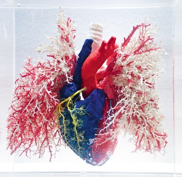 Hart- en vaatziekten zijn verantwoordelijk voor een derde van de overlijdensgevallen.