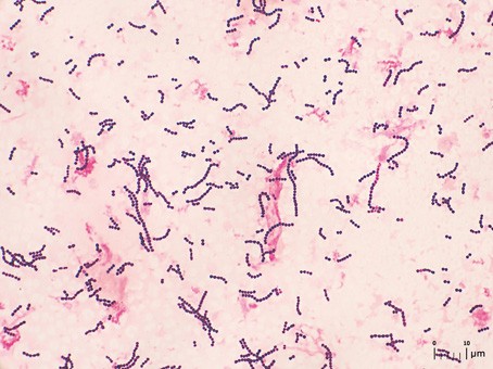 GAS in een grampreparaat