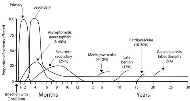 De klinische stadia van syfilis