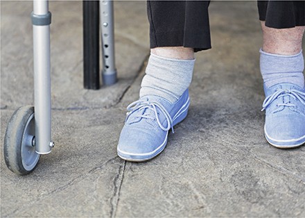 Continue compressietherapie is de meest toegepaste behandeling bij enkeloedeem.