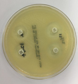 Wereldwijd neemt de prevalentie van extended-spectrumbètalactamaseproducerende bacterieën toe.