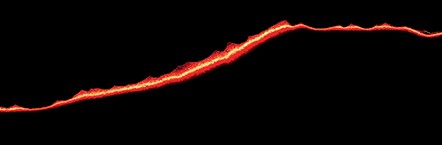 Veel patiënten hebben comedicatie nodig om de pijn optimaal te bestrijden.