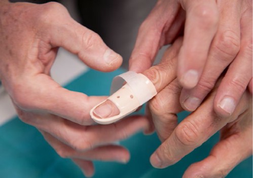 Figuur 6 Stack-spalk