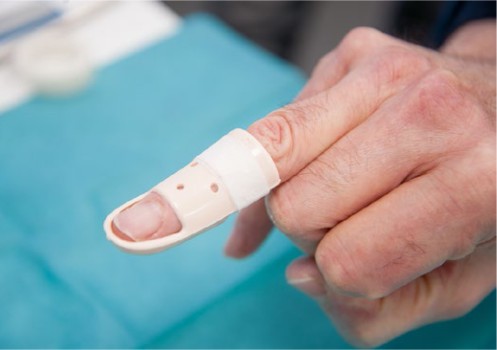 Figuur 7 Stack-spalk