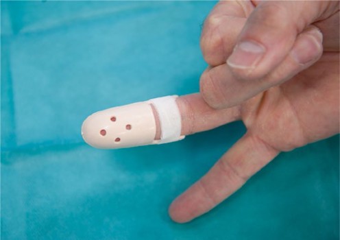 Figuur 8 Stack-spalk