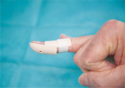 Figuur 9 Stack-spalk