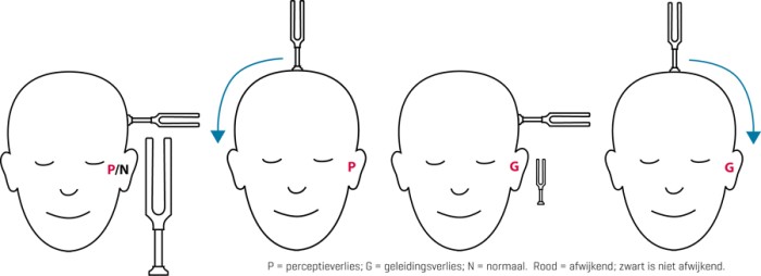 Interpretatie van de resultaten.