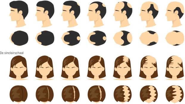 Figuur 2 | De norwoodschaal