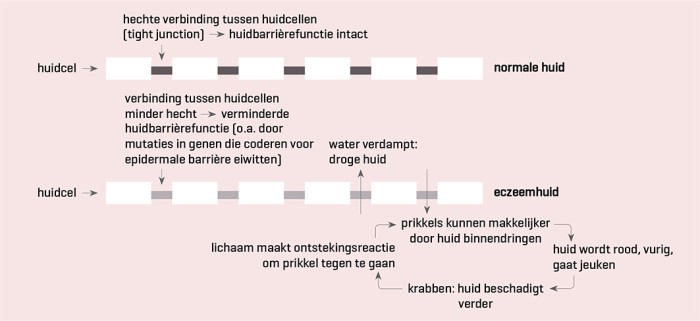 De pathofysiologie van constitutioneel eczeem