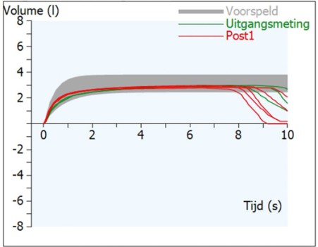 Volume-tijdcurves. De uitgangsmetingen corresponderen met de pre-waarden in de tabellen