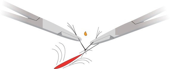 Met weefsellijm worden de gedraaide haarbundels bevestigd.