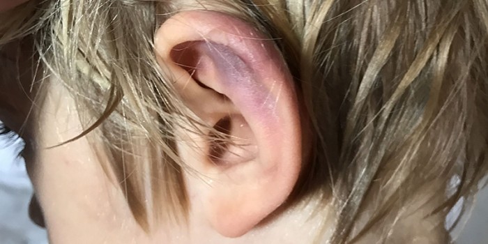 Beschouwing Schouten 2