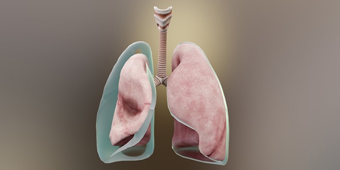 Pneumothorax