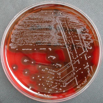 Kolonies van GAS met hemolyse