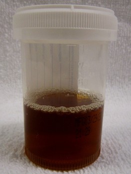 Colakleurige urine