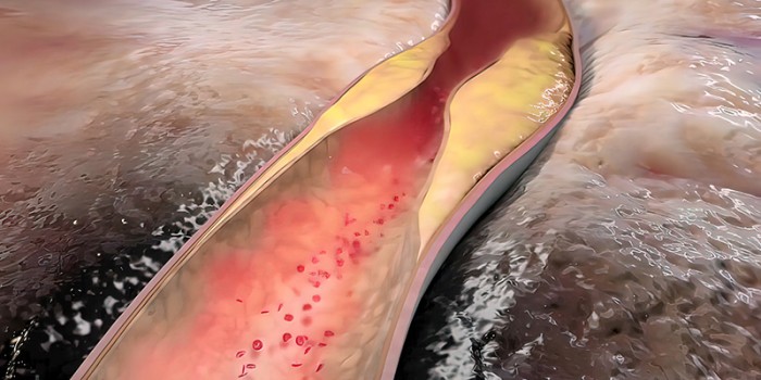 Hart- en vaatziekten