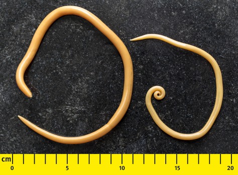 Spoelwormen uit menselijk feces