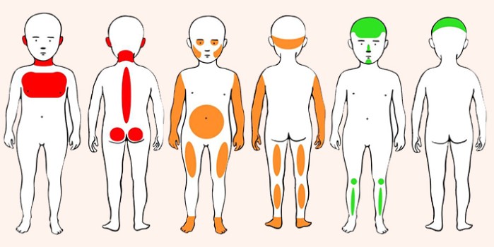 Locaties van accidentele blauwe plekken