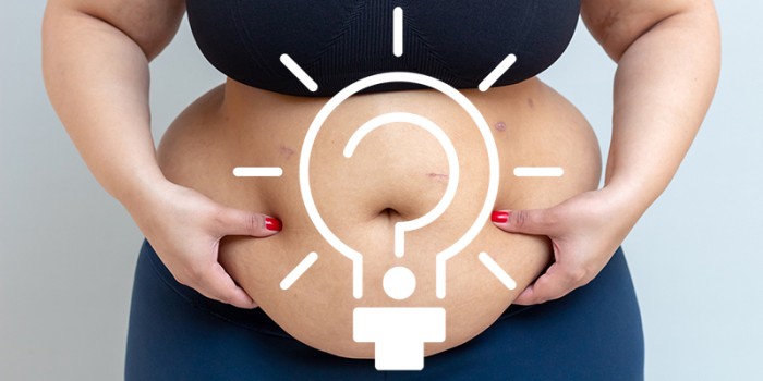 Kennistoets morbide obesitas