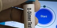 D-dimeertest