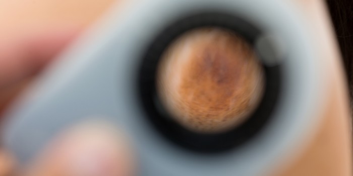 histopathologisch onderzoek