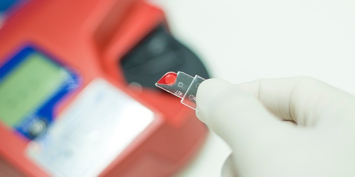 CRP-point-of-care-test