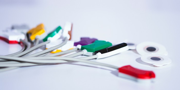 Ecg-afwijkingen bij DM2